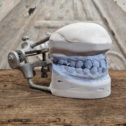 Ancien articulateur dentaire avec moulage en plâtre