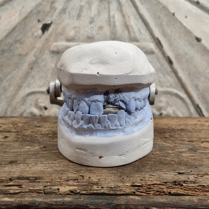 Ancien articulateur dentaire avec moulage en plâtre
