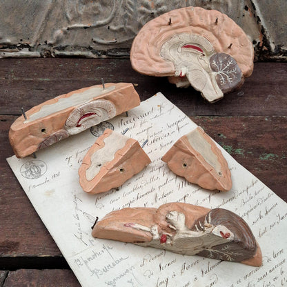 Rare modèle anatomique de cerveau humain, vers 1900