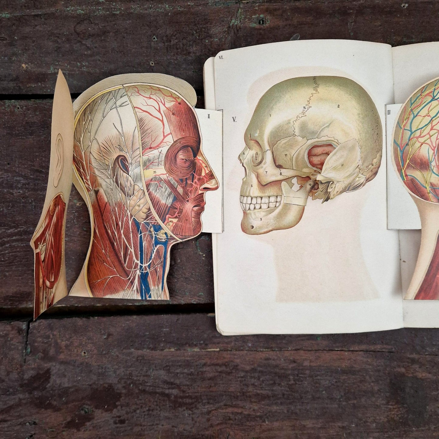Atlas anatomique du Docteur Vernon - Livre à systèmes