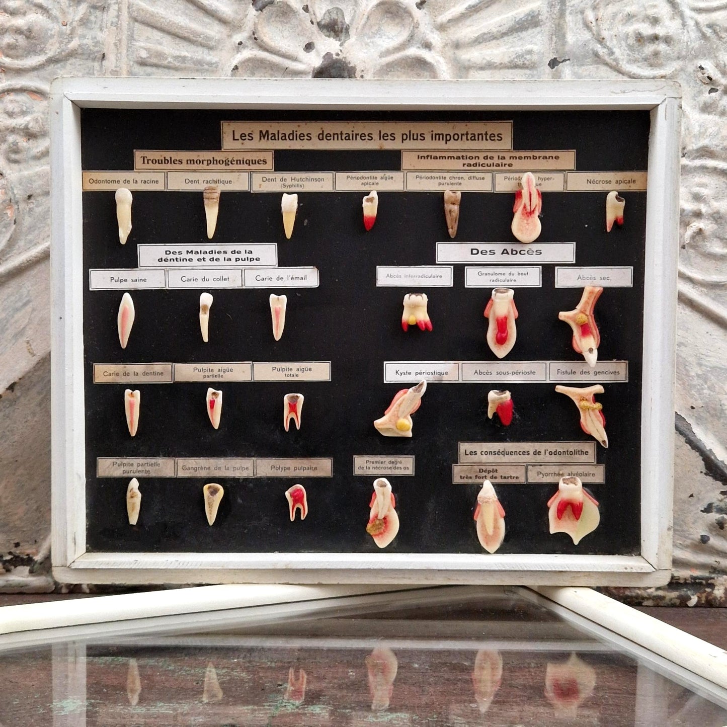Ancien tableau pédagogique des maladies dentaires, dents en relief
