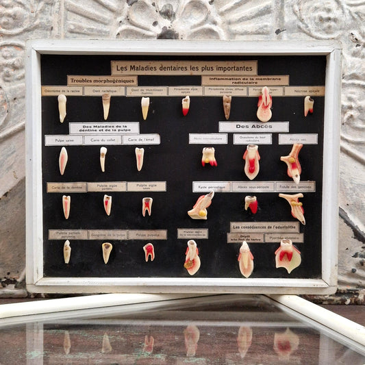 Ancien tableau pédagogique des maladies dentaires, dents en relief
