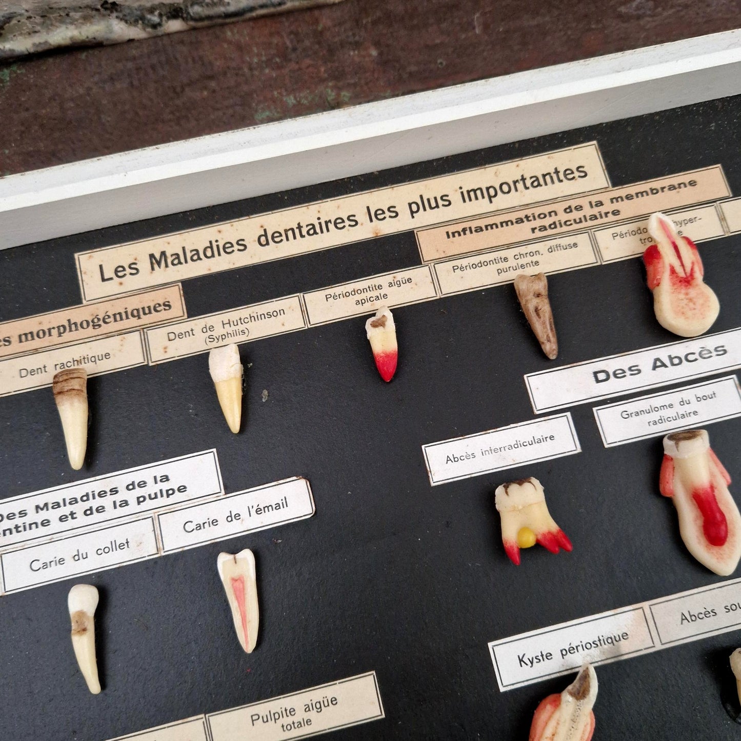 Ancien tableau pédagogique des maladies dentaires, dents en relief