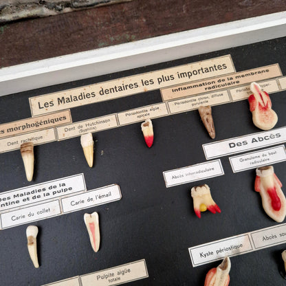 Ancien tableau pédagogique des maladies dentaires, dents en relief