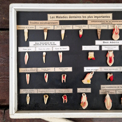 Ancien tableau pédagogique des maladies dentaires, dents en relief