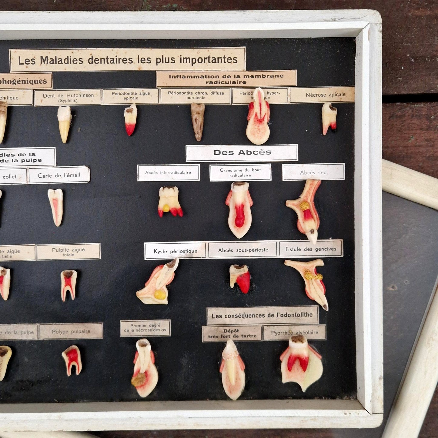 Ancien tableau pédagogique des maladies dentaires, dents en relief