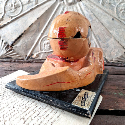 globe oculaire ancien modele belgique